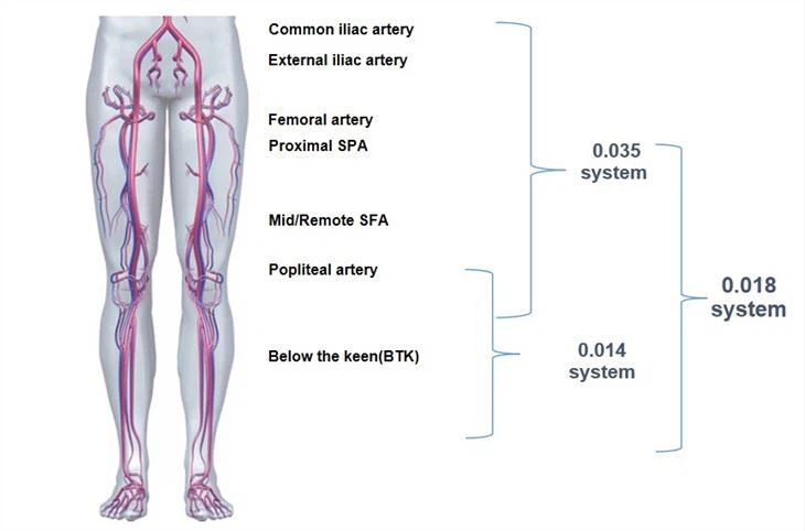 High Pressure Semi-compliant Balloon